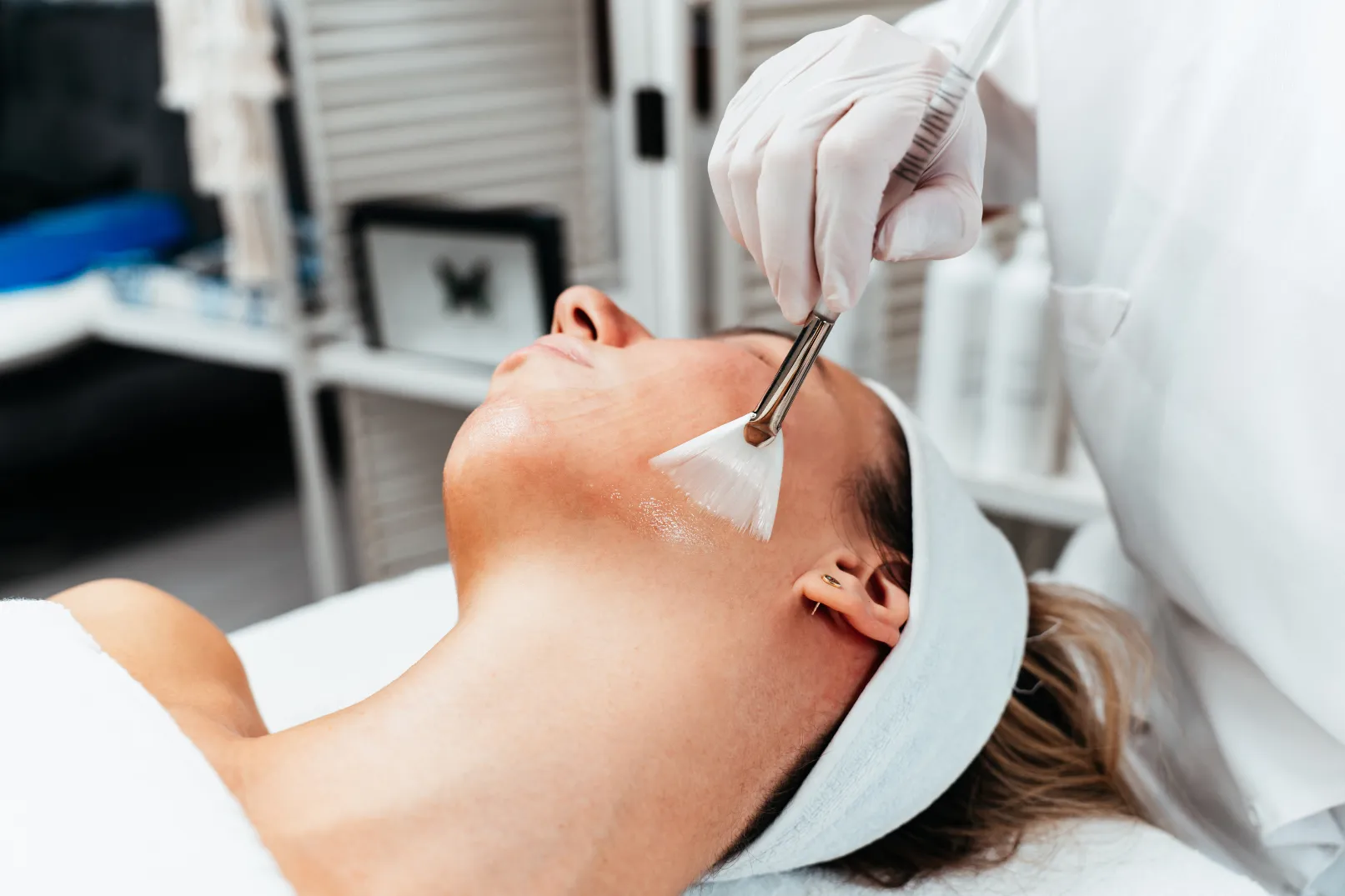 Reveal a Fresh, Radiant Complexion with Customized Chemical Peel Treatments